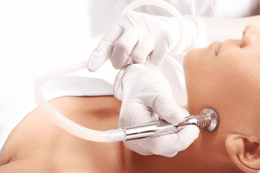 Microdermabrasion treatment perth